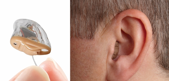 Hearing Aids for Tinnitus - Do They Work Effectively?completely in the ear hearing aid