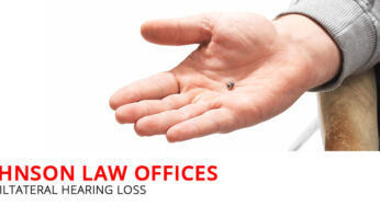 About Uniltateral Hearing Loss